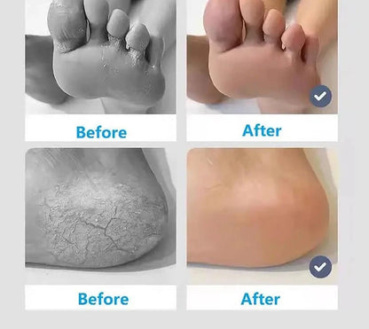 Exfoliate Feet Pedicure Handle